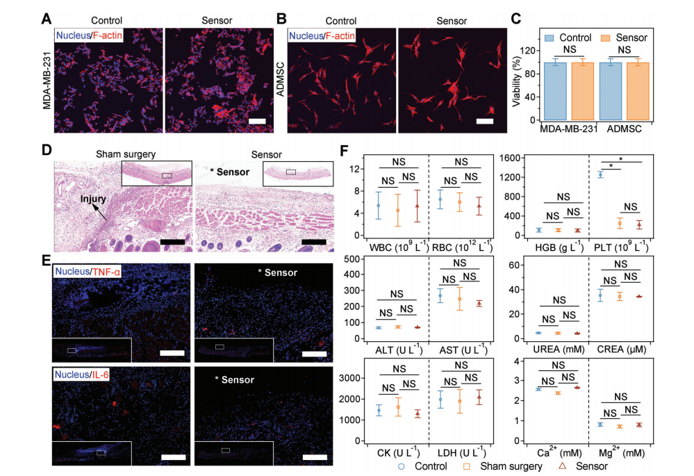 機(jī)械退火破解氨基酸晶體壓電難題！南京大學(xué)造出可生物降解的壓電力傳感器